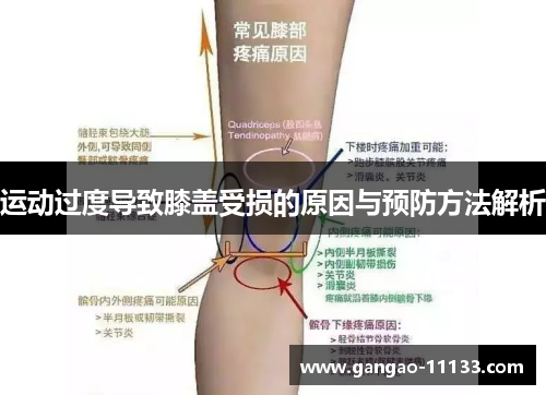 运动过度导致膝盖受损的原因与预防方法解析